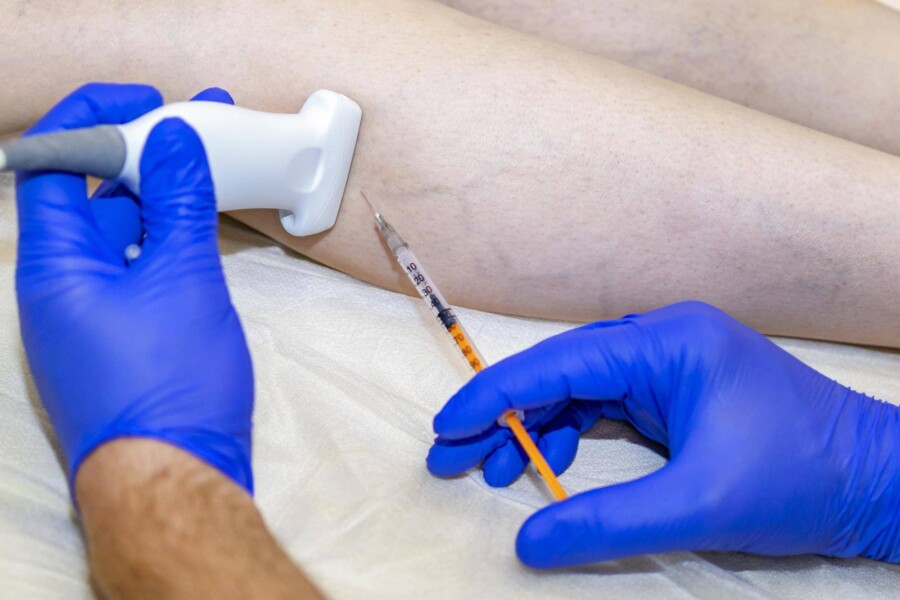 Jak leczyć zakrzepowe zapalenie żył w domowych warunkach?
