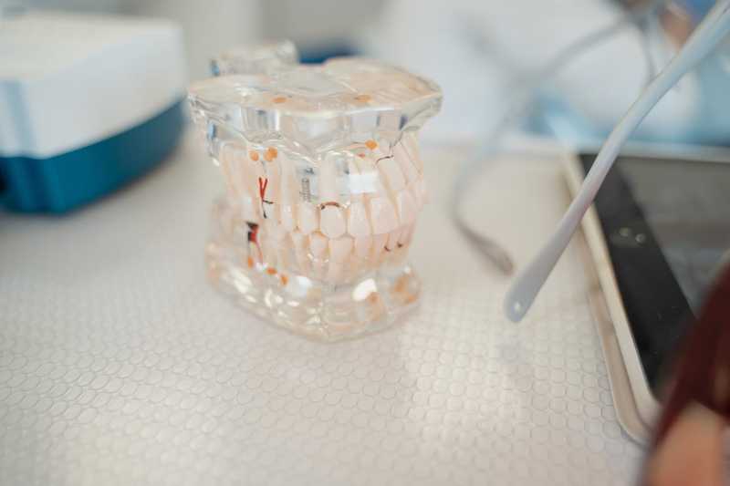 Periimplantitis po implantach zębowych: jak rozpoznać i leczyć?